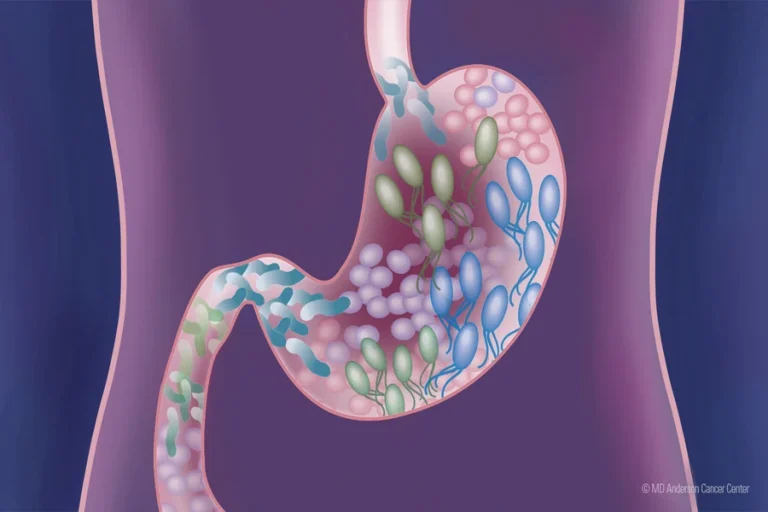 How to Improve Gut Microbiome Simple Effective Steps